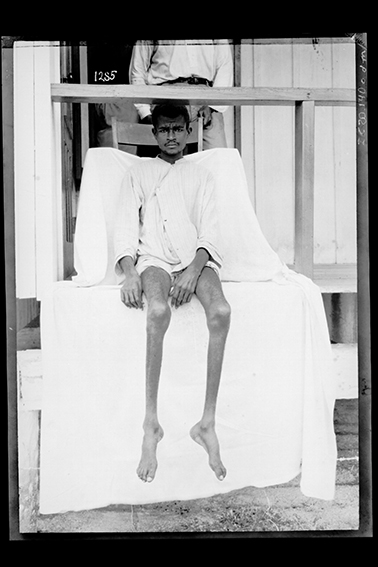 1285 - Trabalhador_Enfermo_no_Hospital_Candelária,_Localizado_entre_Santo_Antonio_do_Rio_Madeira_e_Porto_Velho_-_,_Acervo_do_Museu_Paulista_da_USP.jpg