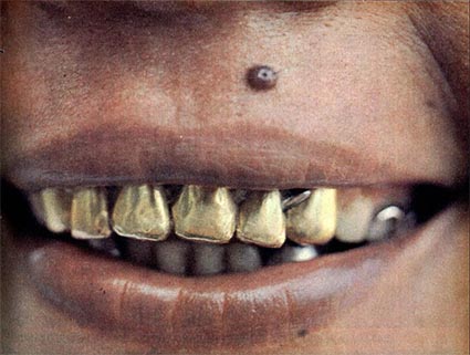 boca_rica_01- Revista Manchete - 1983.jpg